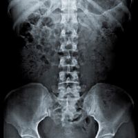 1 Radiografia